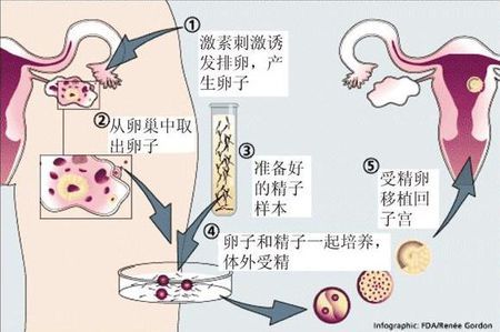 供卵代怀包男孩生殖医学中心